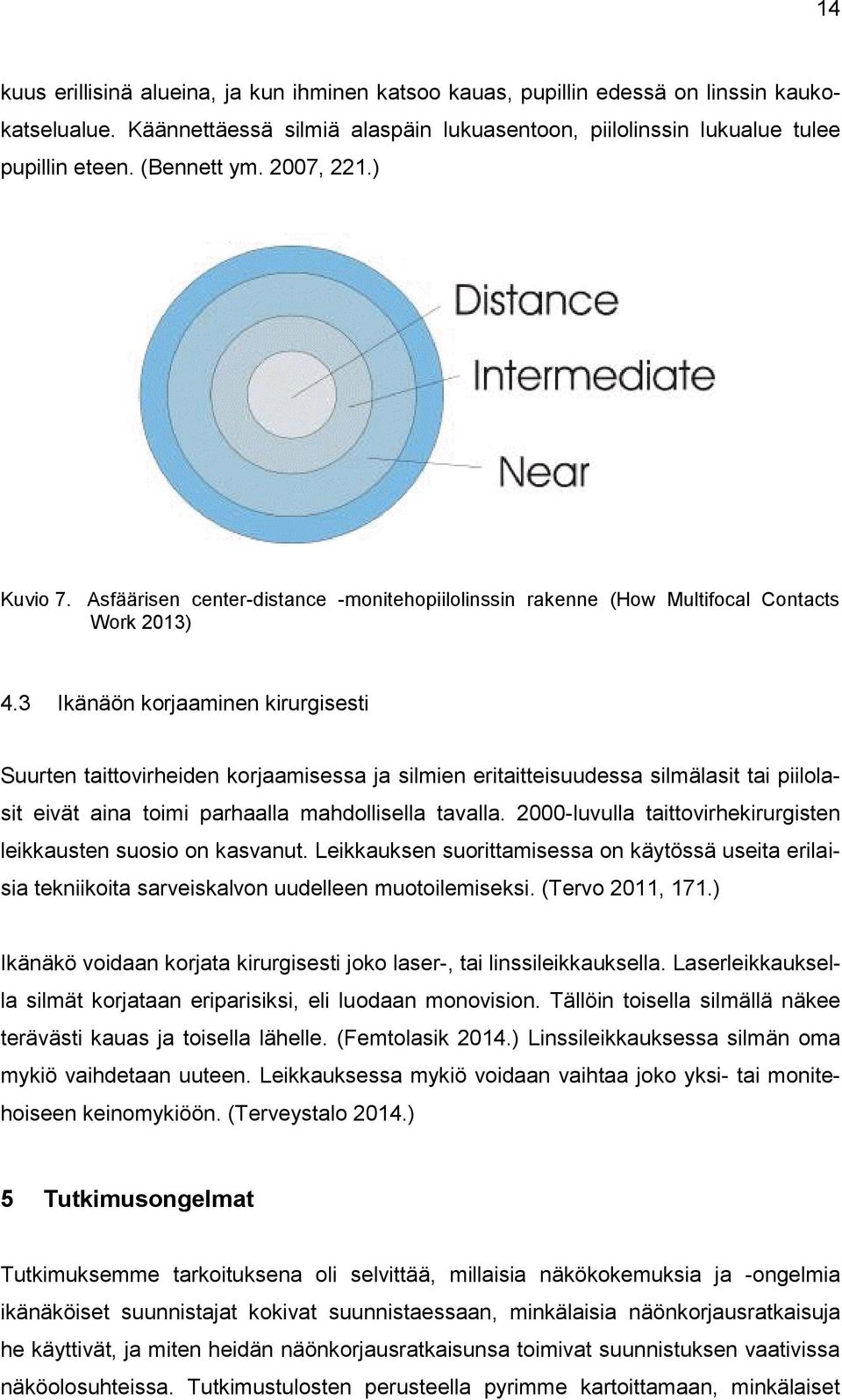 3 Ikänäön korjaaminen kirurgisesti Suurten taittovirheiden korjaamisessa ja silmien eritaitteisuudessa silmälasit tai piilolasit eivät aina toimi parhaalla mahdollisella tavalla.