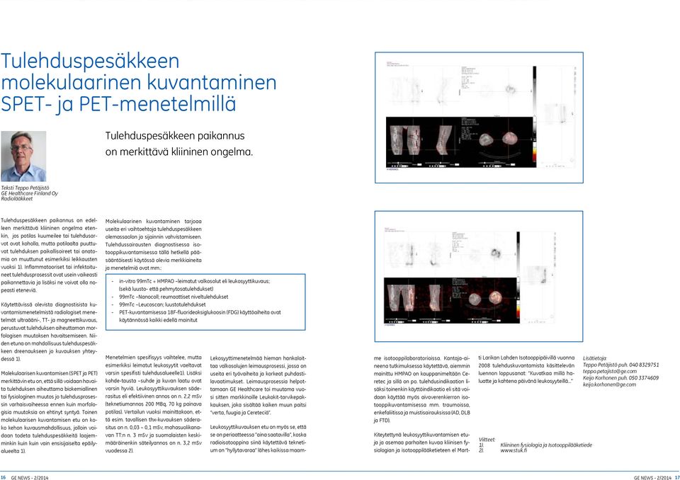 potilaalta puuttuvat tulehduksen paikallisoireet tai anatomia on muuttunut esimerkiksi leikkausten vuoksi 1).