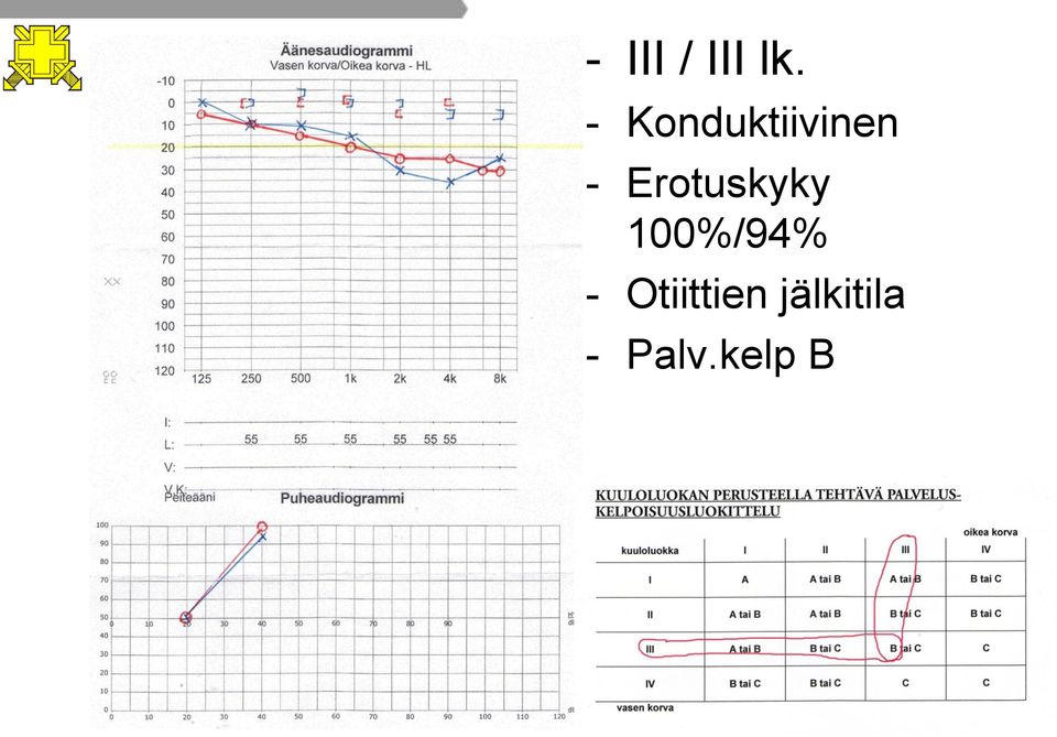 Erotuskyky 100%/94% -