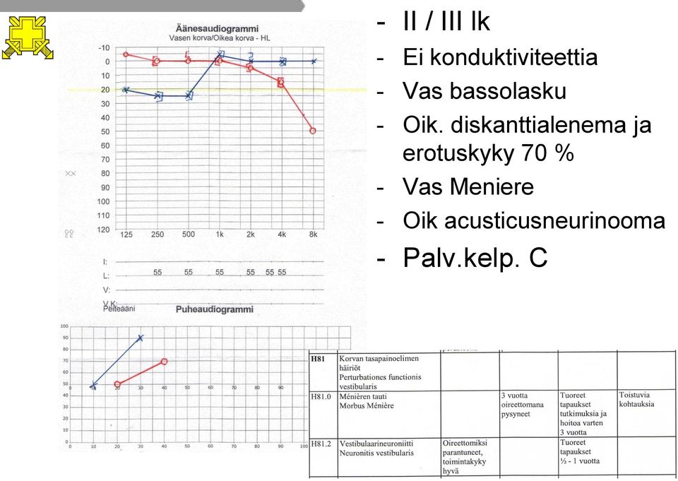 diskanttialenema ja erotuskyky 70 % -