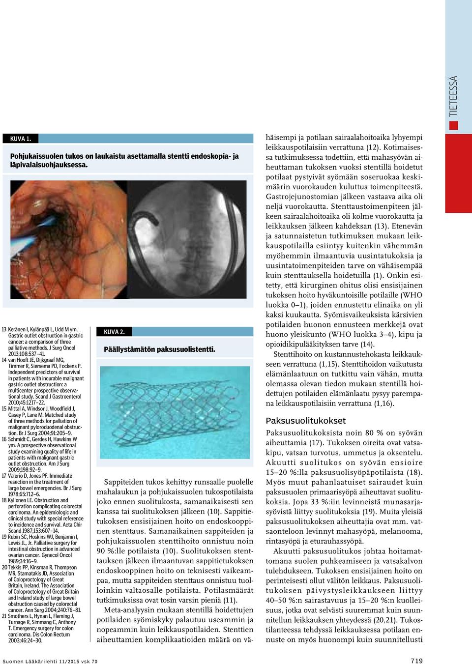 Independent predictors of survival in patients with incurable malignant gastric outlet obstruction: a multicenter prospective observational study. Scand J Gastroenterol 2010;45:1217 22.