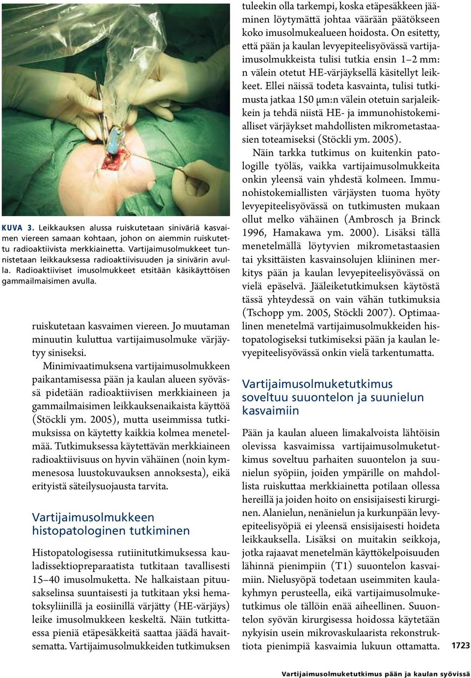 Jo muutaman minuutin kuluttua vartijaimusolmuke värjäytyy siniseksi.