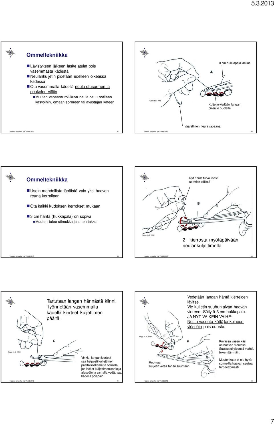 Haavan ompelu/ Irja Ventä 2013 38 Ommeltekniikka Nyt neula turvallisesti sormien välissä Usein mahdollista läpäistä vain yksi haavan reuna kerrallaan Ota kaikki kudoksen kerrokset mukaan 3 cm häntä
