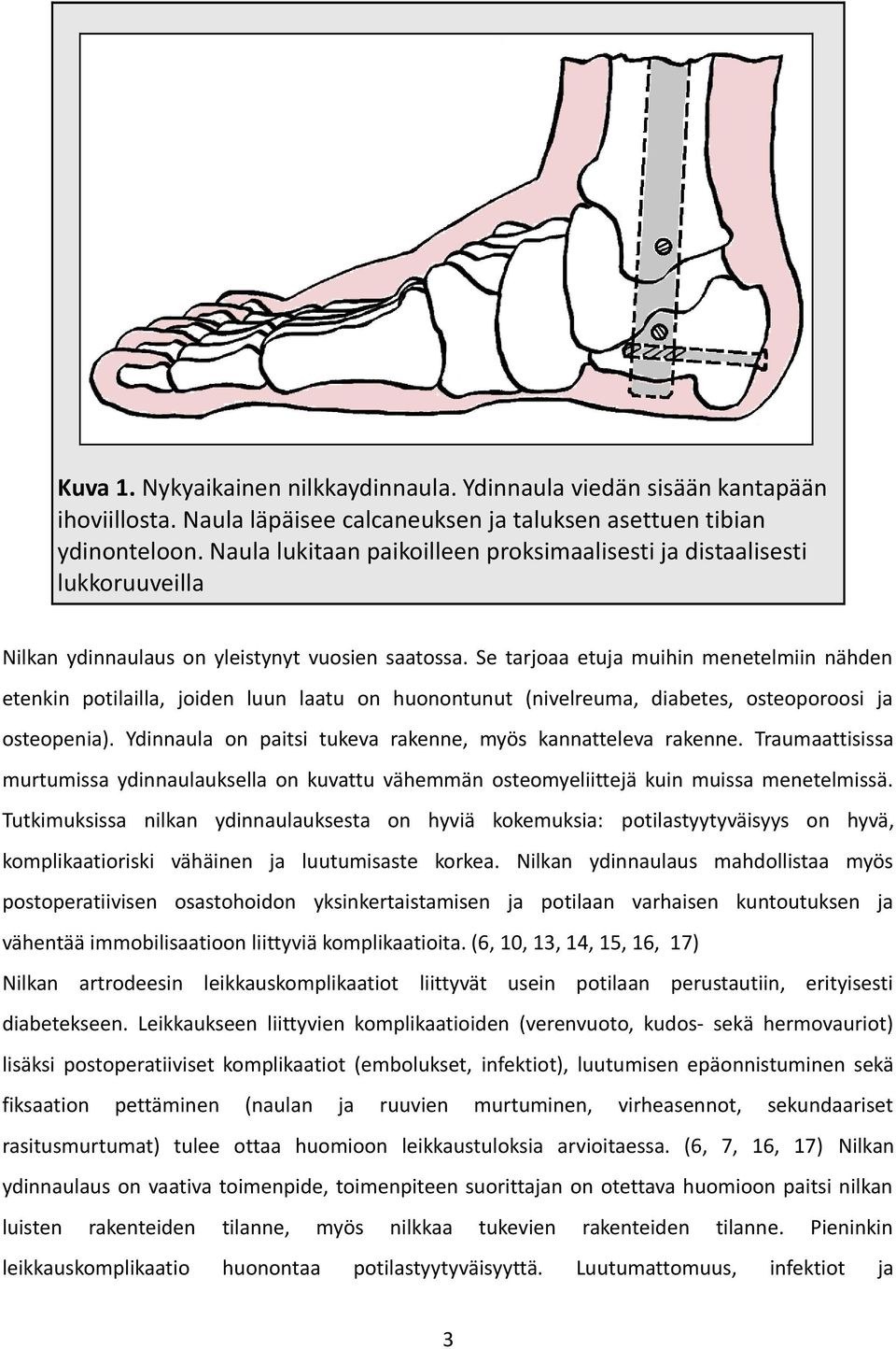 Se tarjoaa etuja muihin menetelmiin nähden etenkin potilailla, joiden luun laatu on huonontunut (nivelreuma, diabetes, osteoporoosi ja osteopenia).