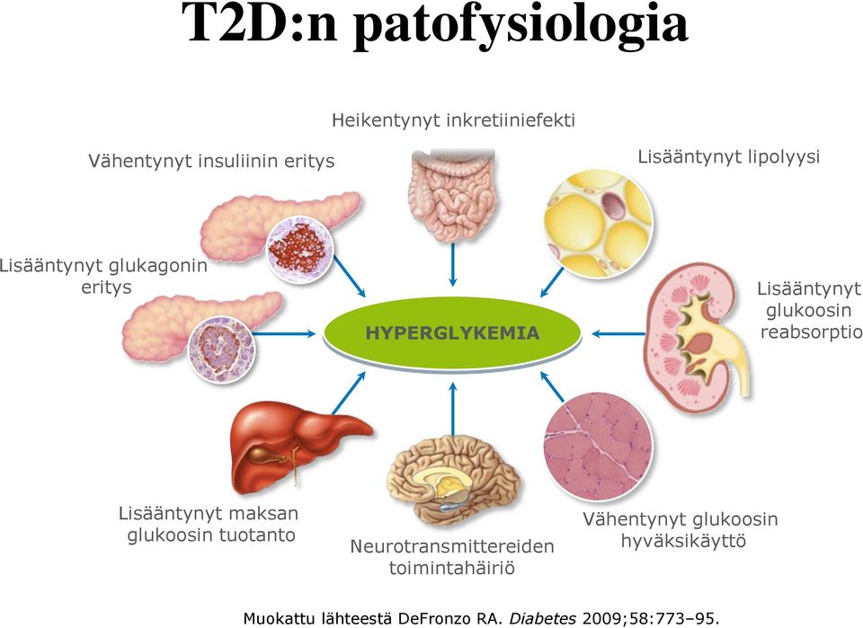 glukoosin reabsorptio Lisääntynyt maksan glukoosin tuotanto Neurotransmittereiden