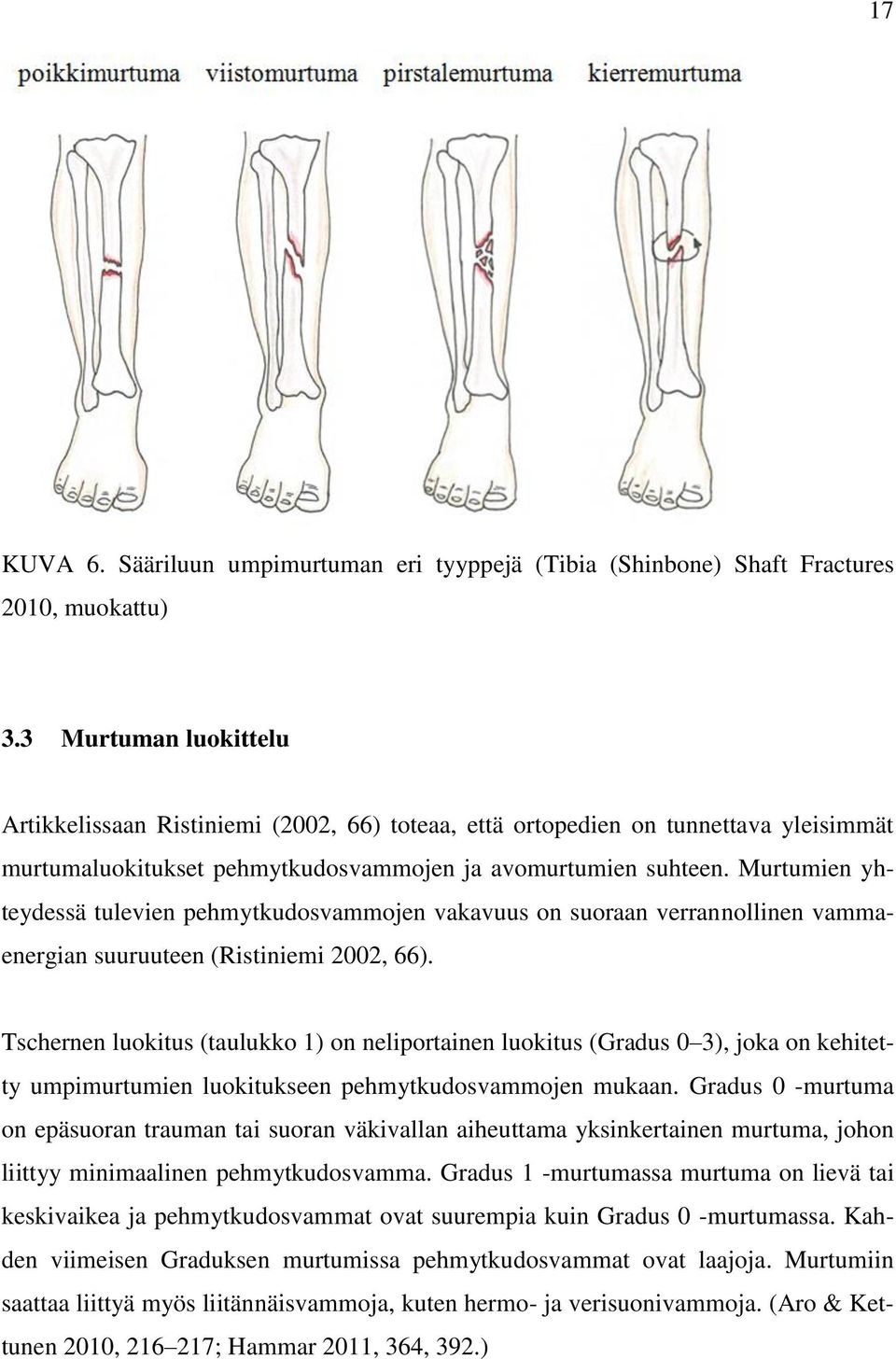 Murtumien yhteydessä tulevien pehmytkudosvammojen vakavuus on suoraan verrannollinen vammaenergian suuruuteen (Ristiniemi 2002, 66).