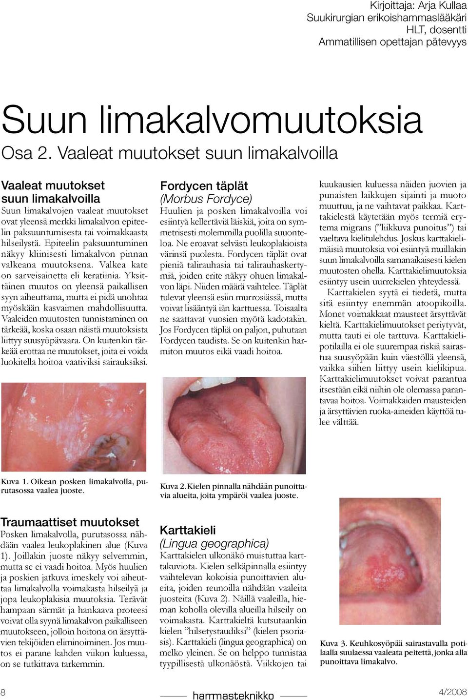 Epiteelin paksuuntuminen näkyy kliinisesti limakalvon pinnan valkeana muutoksena. Valkea kate on sarveisainetta eli keratiinia.