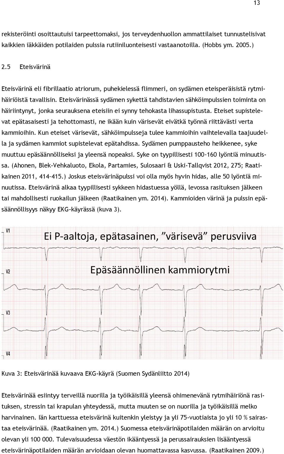 Eteisvärinässä sydämen sykettä tahdistavien sähköimpulssien toiminta on häiriintynyt, jonka seurauksena eteisiin ei synny tehokasta lihassupistusta.