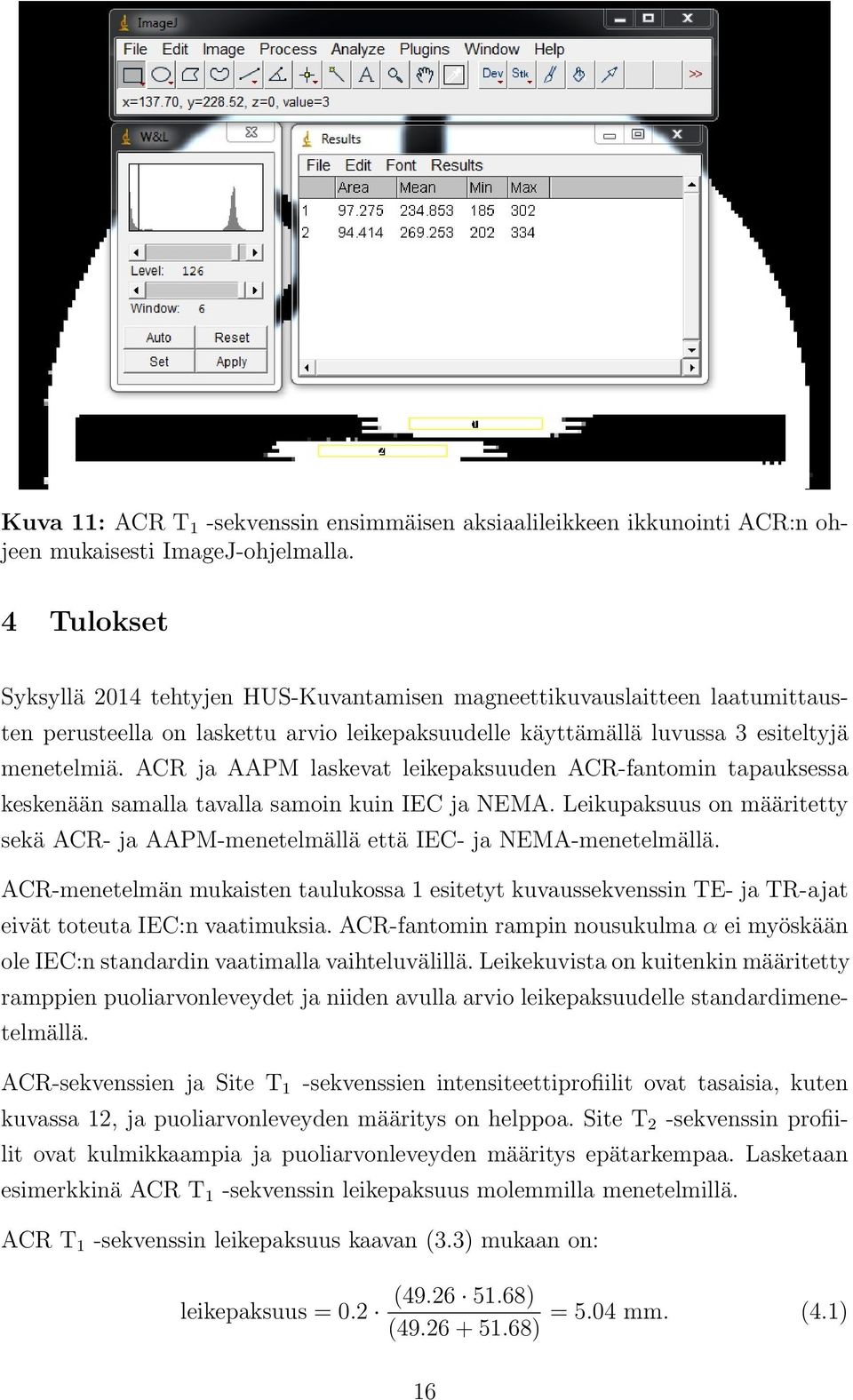 ACR ja AAPM laskevat leikepaksuuden ACR-fantomin tapauksessa keskenään samalla tavalla samoin kuin IEC ja NEMA.
