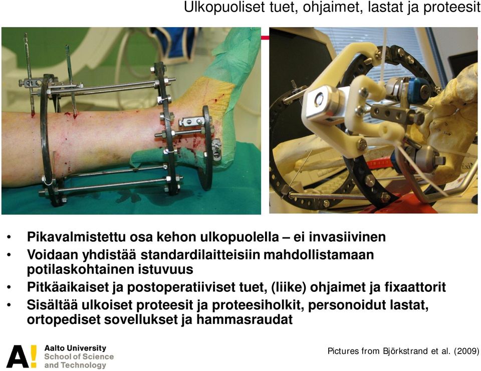 Pitkäaikaiset ja postoperatiiviset tuet, (liike) ohjaimet ja fixaattorit Sisältää ulkoiset proteesit