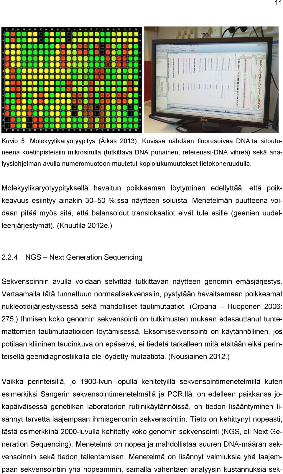 tietokoneruudulla. Molekyylikaryotyypityksellä havaitun poikkeaman löytyminen edellyttää, että poikkeavuus esiintyy ainakin 30 50 %:ssa näytteen soluista.