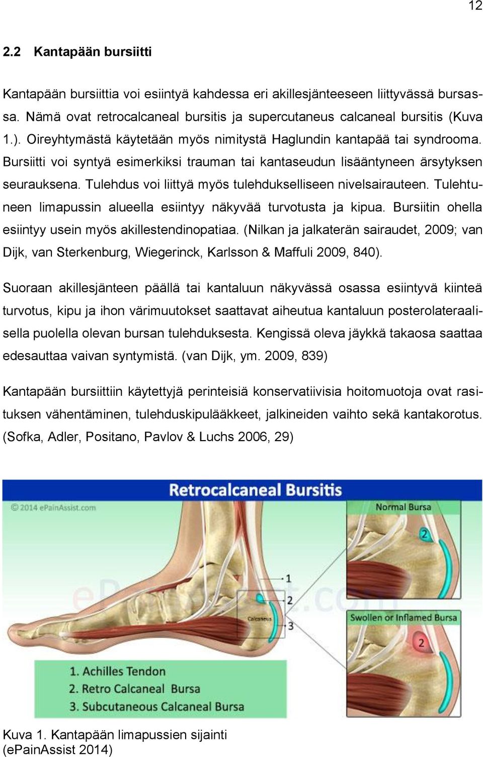 Tulehdus voi liittyä myös tulehdukselliseen nivelsairauteen. Tulehtuneen limapussin alueella esiintyy näkyvää turvotusta ja kipua. Bursiitin ohella esiintyy usein myös akillestendinopatiaa.