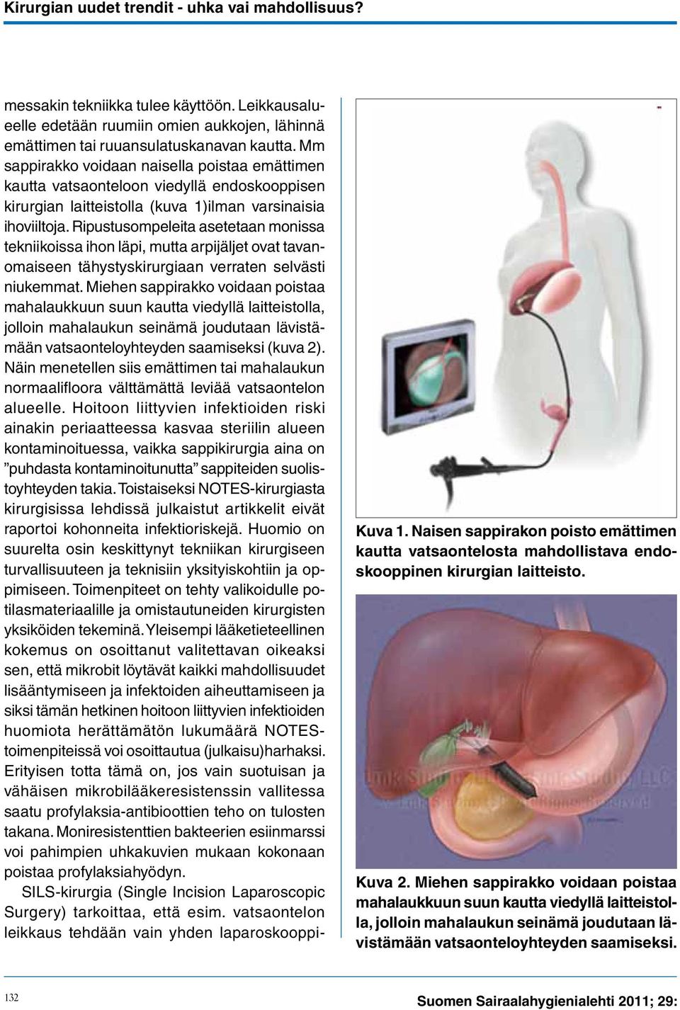 Ripustusompeleita asetetaan monissa tekniikoissa ihon läpi, mutta arpijäljet ovat tavanomaiseen tähystyskirurgiaan verraten selvästi niukemmat.