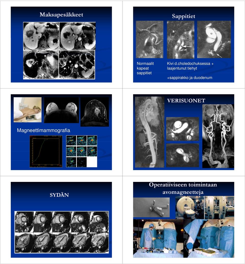 sappitiet +sappirakko ja duodenum VERISUONET