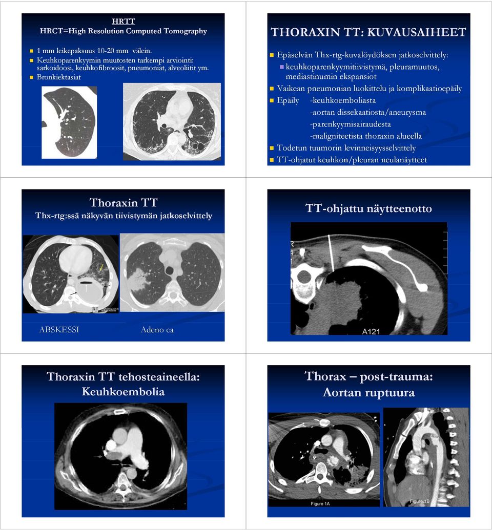 komplikaatioepäily Epäily -keuhkoemboliasta -aortan dissekaatiosta/aneurysma -parenkyymisairaudesta -maligniteetista thoraxin alueella Todetun tuumorin levinneisyysselvittely i l itt l TT-ohjatut