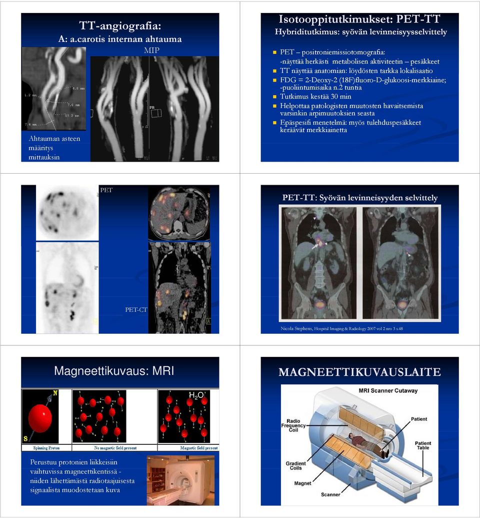 TT näyttää ää anatomian: löydösten tarkka lokalisaatio li i FDG = 2-Deoxy-2 (18F)fluoro fluoro-d-glukoosi-merkkiaine; -puoliintumisaika n.