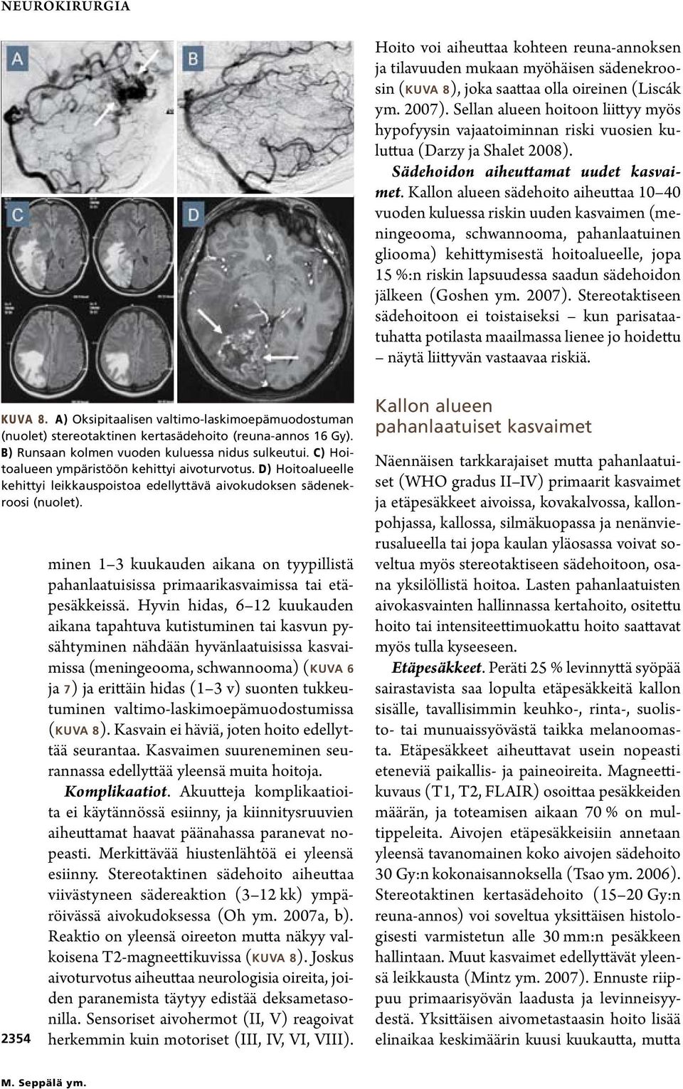 Kallon alueen sädehoito aiheuttaa 10 40 vuoden kuluessa riskin uuden kasvaimen (meningeooma, schwannooma, pahanlaatuinen gliooma) kehittymisestä hoitoalueelle, jopa 15 %:n riskin lapsuudessa saadun