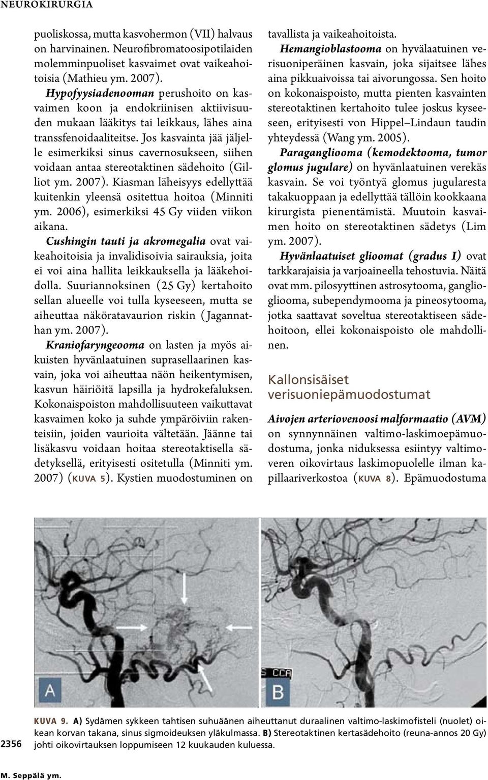 Jos kasvainta jää jäljelle esimerkiksi sinus cavernosukseen, siihen voidaan antaa stereotaktinen sädehoito (Gilliot ym. 2007).