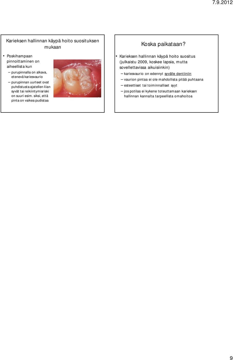 Karieksen hallinnan käypä hoito suositus (julkaistu 2009, koskee lapsia, mutta sovellettavissa aikuisiinkin) kariesvaurio on edennyt syvälle dentiiniin