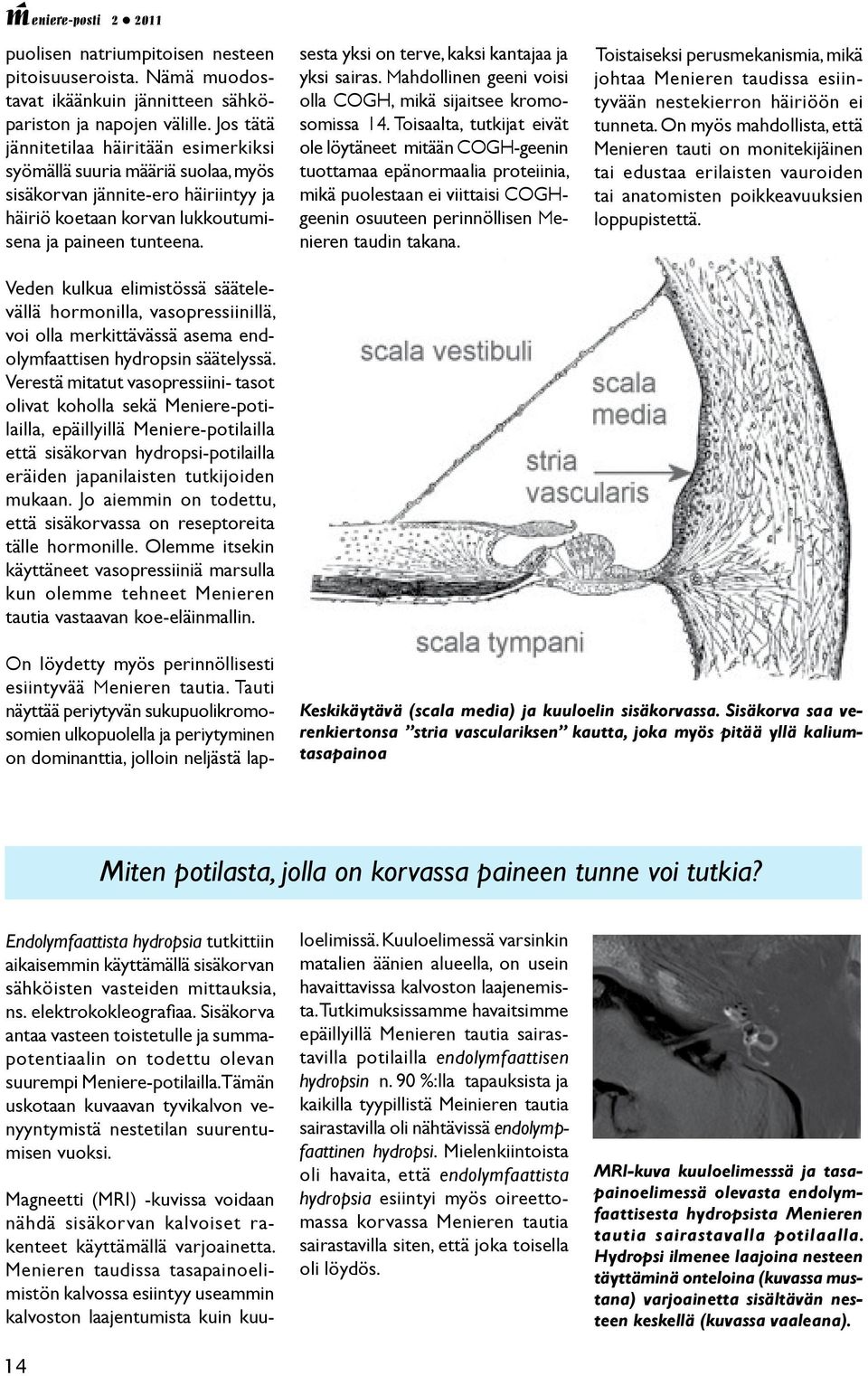 Nämä muodostavat ikäänkuin jännitteen sähköpariston ja napojen välille.