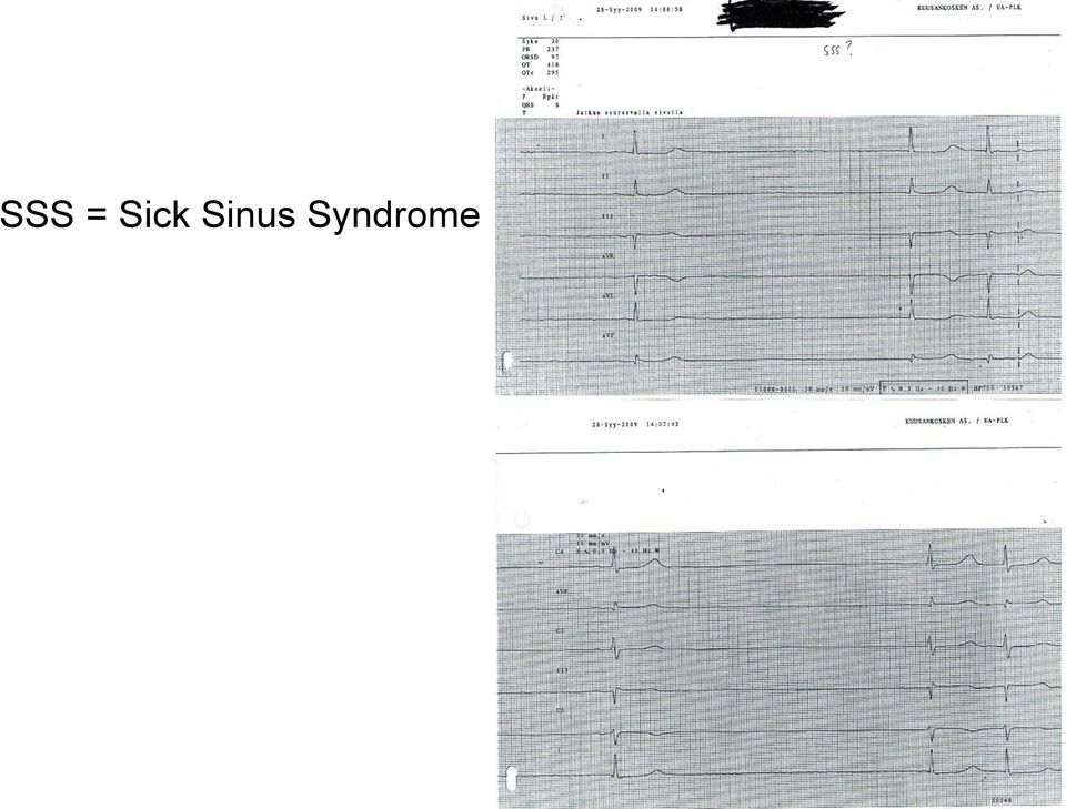 Sinus