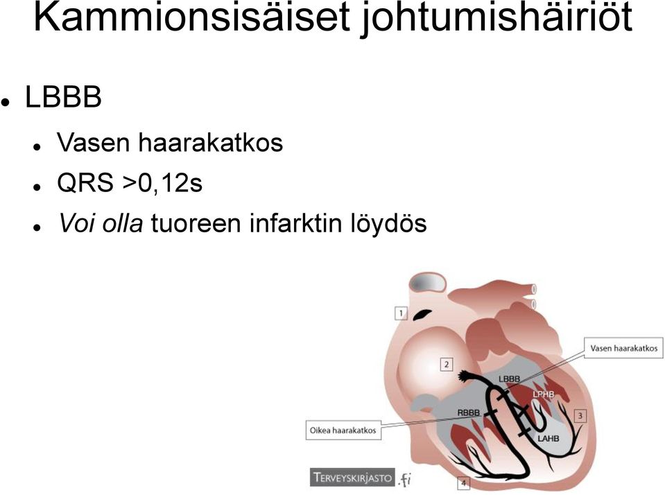 Vasen haarakatkos QRS