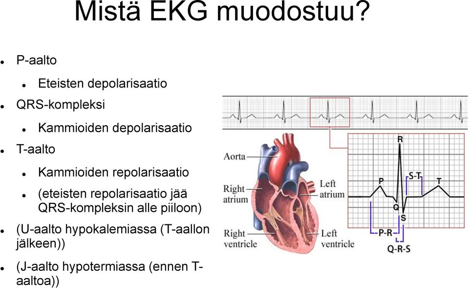 depolarisaatio T-aalto Kammioiden repolarisaatio (eteisten