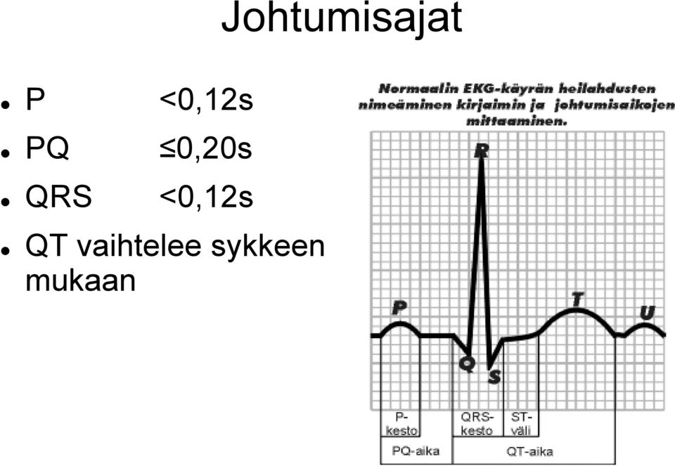 QRS <0,12s QT