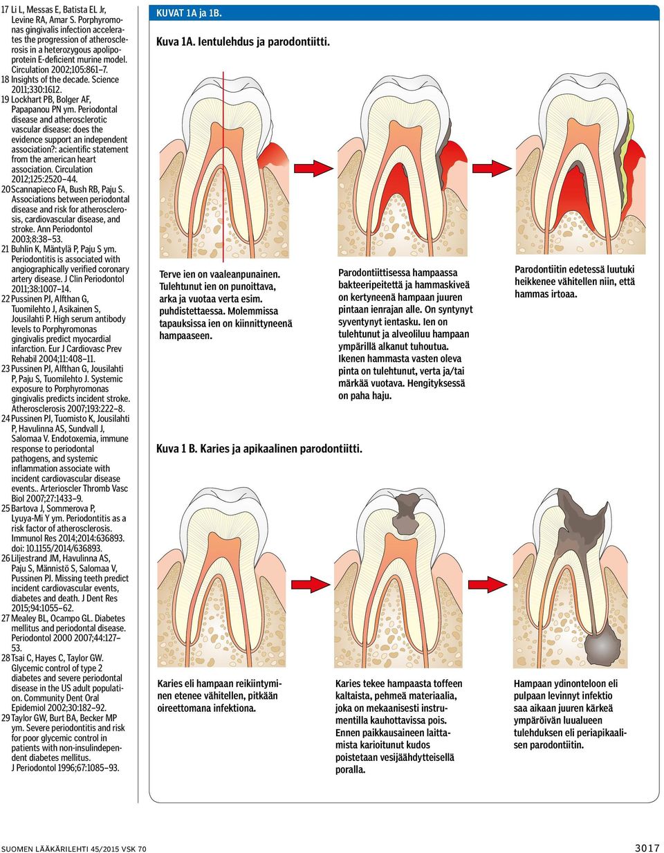 Periodontal disease and atherosclerotic vascular disease: does the evidence support an independent association?: acientific statement from the american heart association. Circulation 2012;125:2520 44.