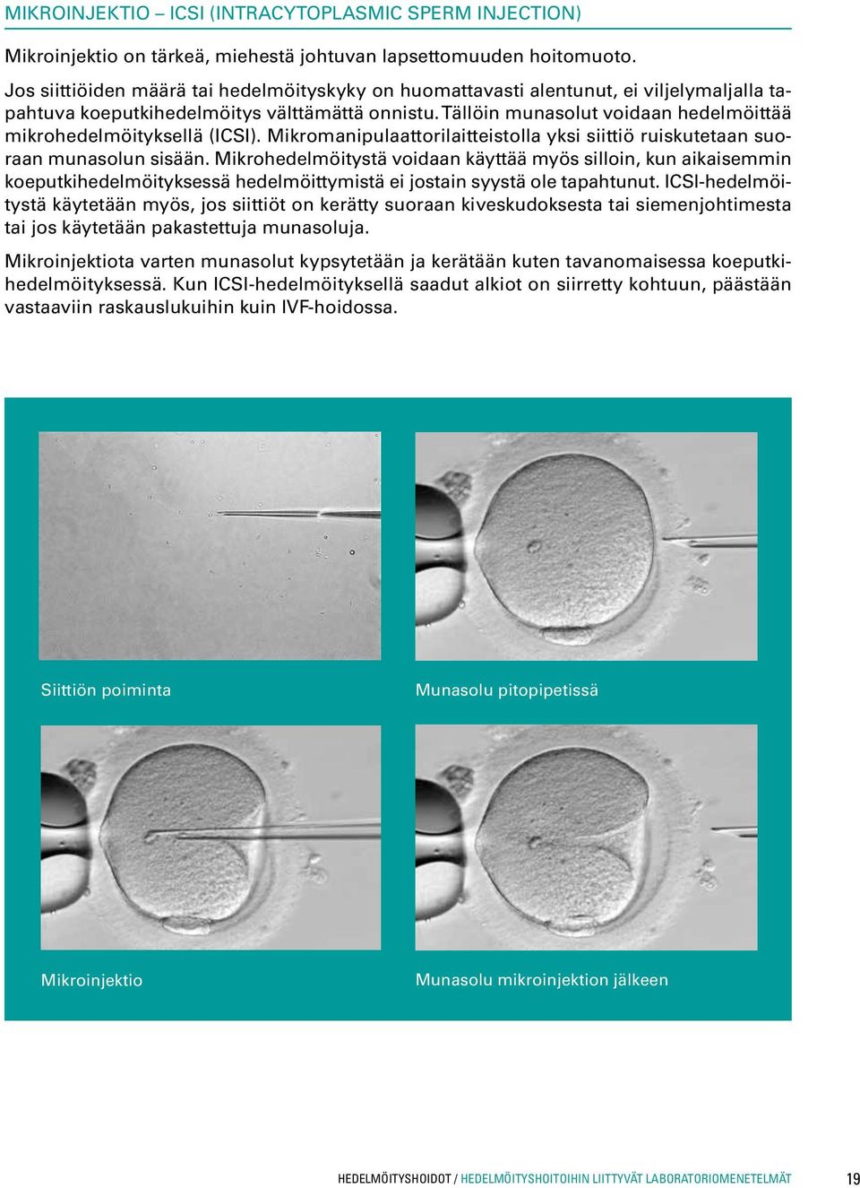 Tällöin munasolut voidaan hedelmöittää mikrohedelmöityksellä (ICSI). Mikromanipulaattorilaitteistolla yksi siittiö ruiskutetaan suoraan munasolun sisään.