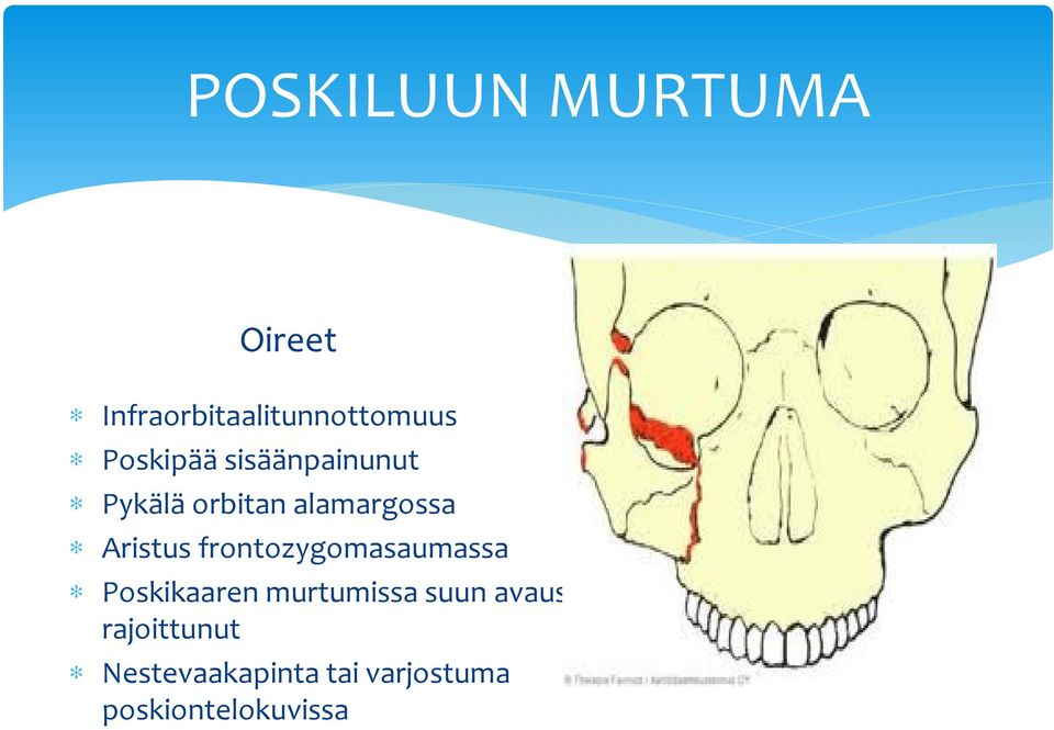 orbitan alamargossa Aristus frontozygomasaumassa Poskikaaren