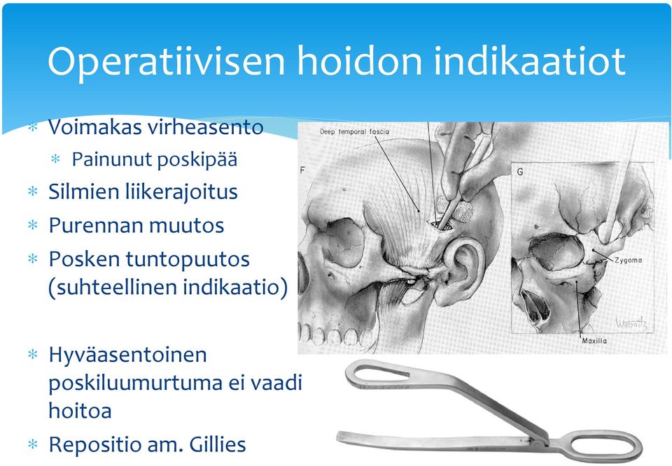 Posken tuntopuutos (suhteellinen indikaatio)