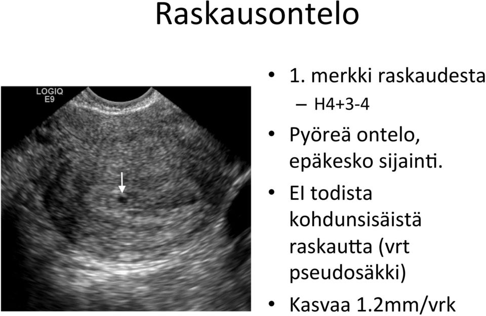 ontelo, epäkesko sijainl.