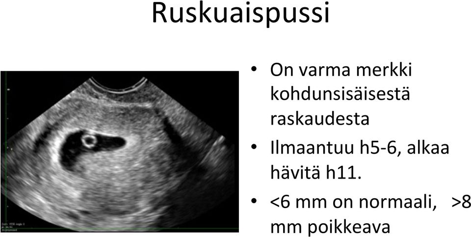 Ilmaantuu h5-6, alkaa hävitä