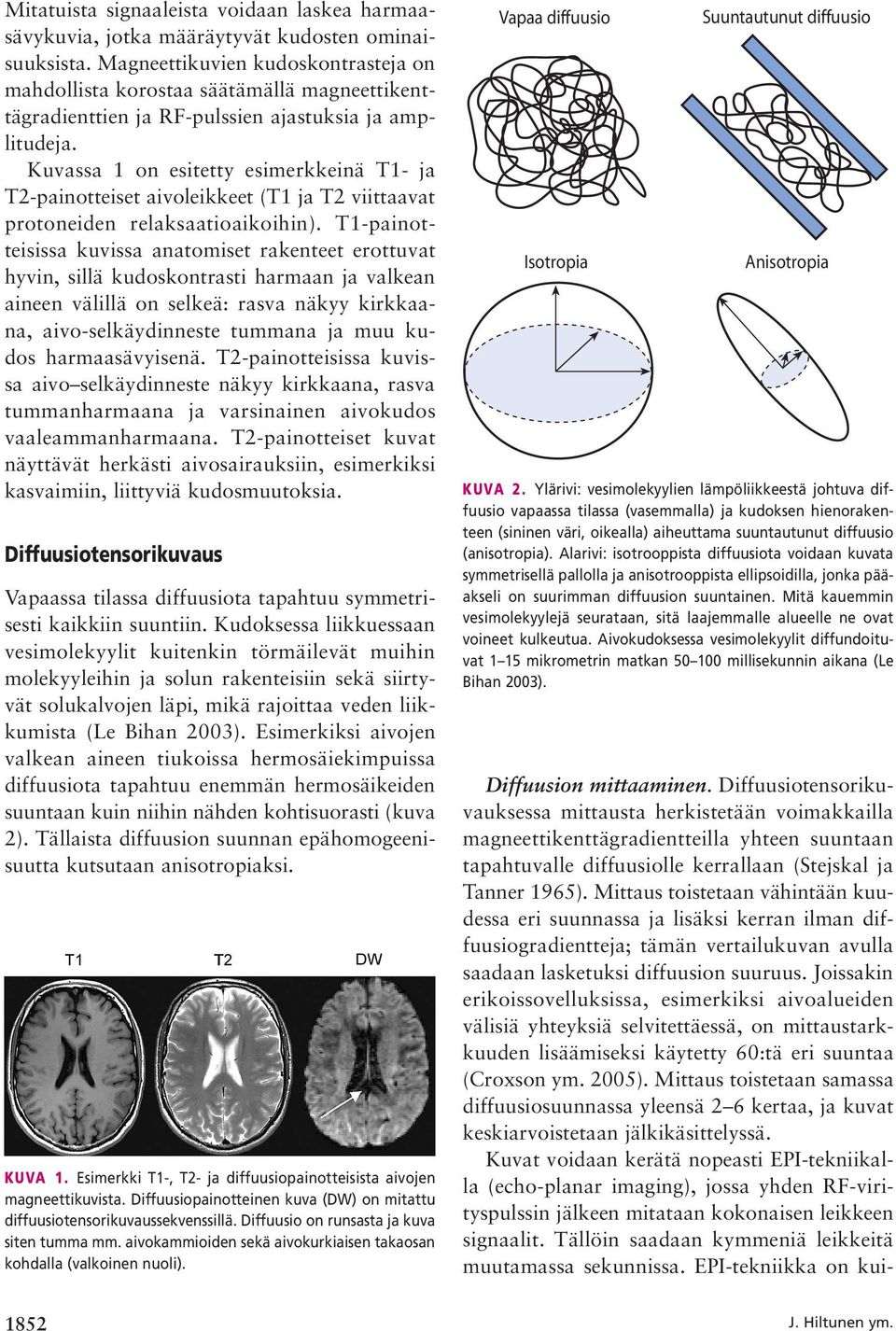 Kuvassa 1 on esitetty esimerkkeinä T1- ja T2-painotteiset aivoleikkeet (T1 ja T2 viittaavat protoneiden relaksaatioaikoihin).