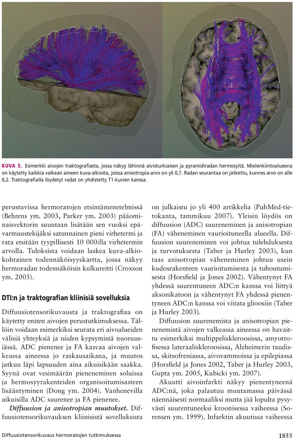 Traktografialla löydetyt radat on yhdistetty T1-kuvien kanssa. perustuvissa hermoratojen etsintämenetelmissä (Behrens ym. 2003, Parker ym.