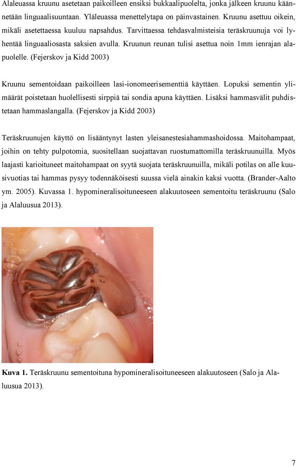 Kruunun reunan tulisi asettua noin 1mm ienrajan alapuolelle. (Fejerskov ja Kidd 2003) Kruunu sementoidaan paikoilleen lasi-ionomeerisementtiä käyttäen.