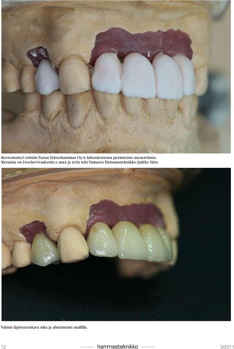 Keramia on Ivoclarvivadentin e.