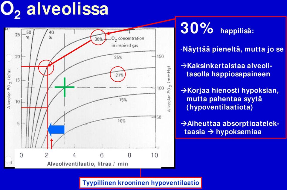 mutta pahentaa syytä (hypoventilaatiota) Aiheuttaa absorptioatelektaasia