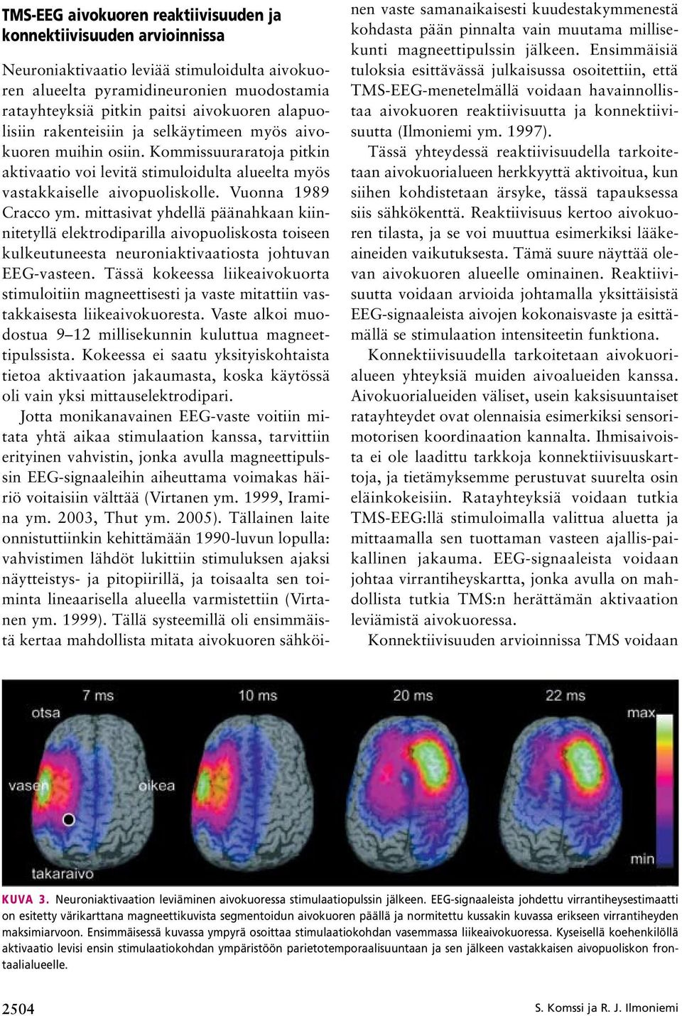 Vuonna 1989 Cracco ym. mittasivat yhdellä päänahkaan kiinnitetyllä elektrodiparilla aivopuoliskosta toiseen kulkeutuneesta neuroniaktivaatiosta johtuvan EEG vasteen.