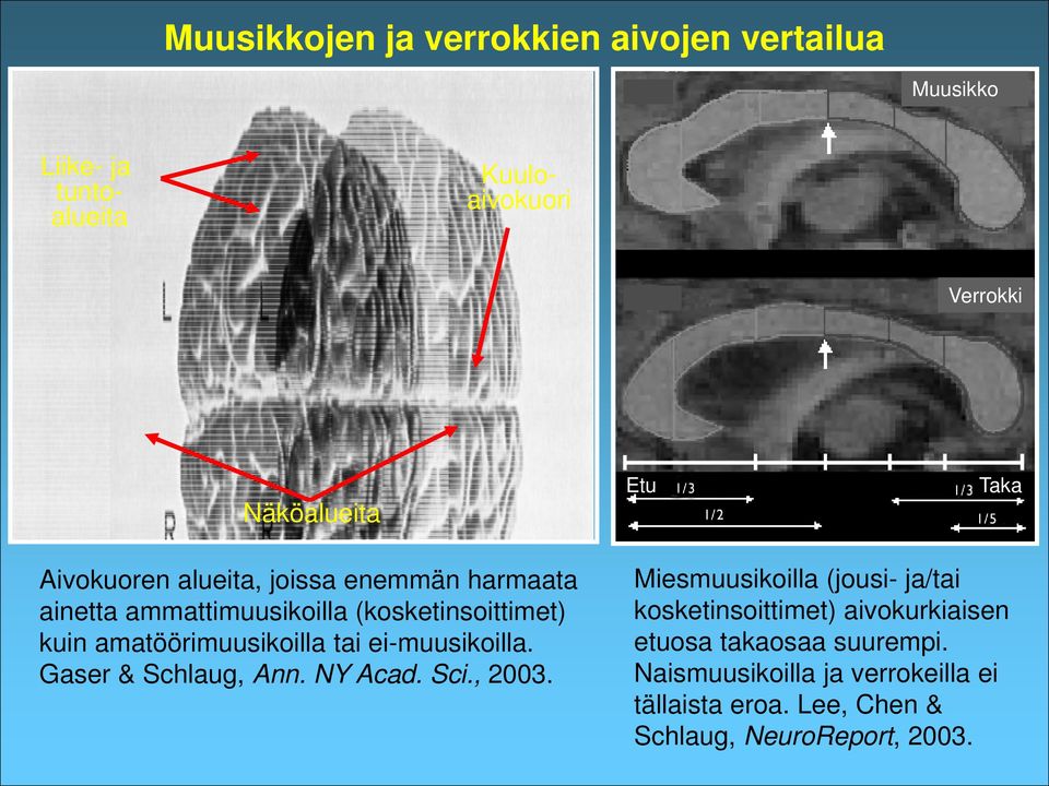 amatöörimuusikoilla tai ei-muusikoilla. Gaser & Schlaug, Ann. NY Acad. Sci., 2003.