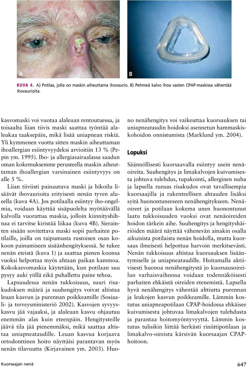 Yli kymmenen vuotta sitten maskin aiheuttaman ihoallergian esiintyvyydeksi arvioitiin 13 % (Pepin ym. 1995).