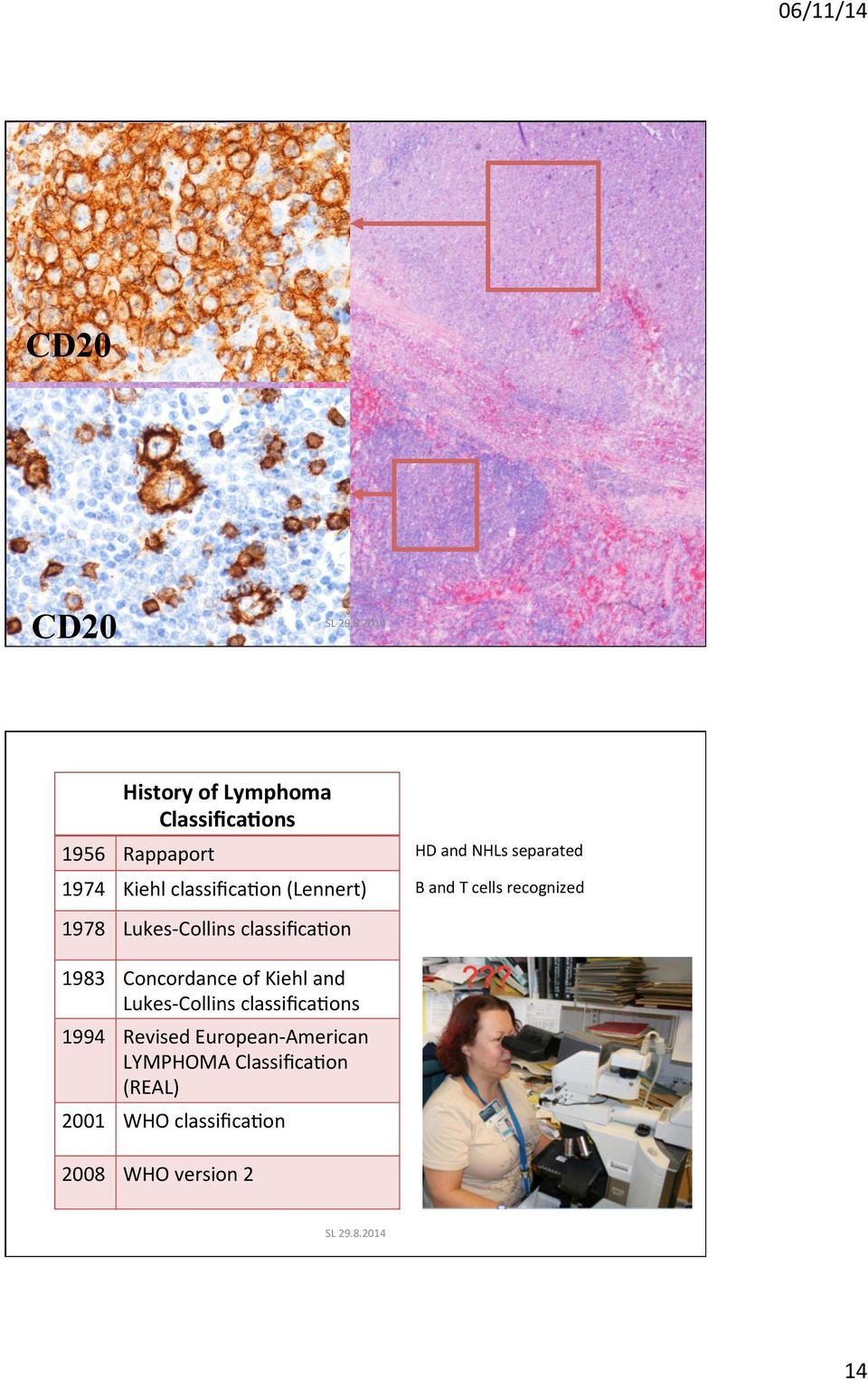 classiﬁca_on (Lennert) B and T cells recognized 1978 Lukes- Collins classiﬁca_on 1983