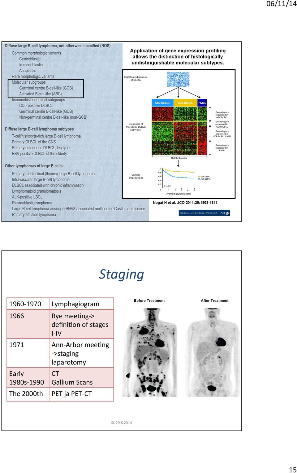 3-1811 SL 29.8.2014 Staging 1960-1970 Lymphagiogram 1966 Rye mee_ng- > deﬁni_on of stages I-