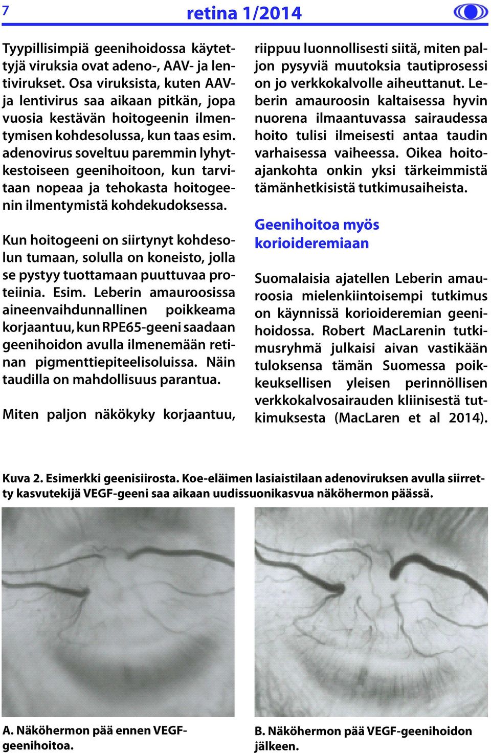 adenovirus soveltuu paremmin lyhytkestoiseen geenihoitoon, kun tarvitaan nopeaa ja tehokasta hoitogeenin ilmentymistä kohdekudoksessa.