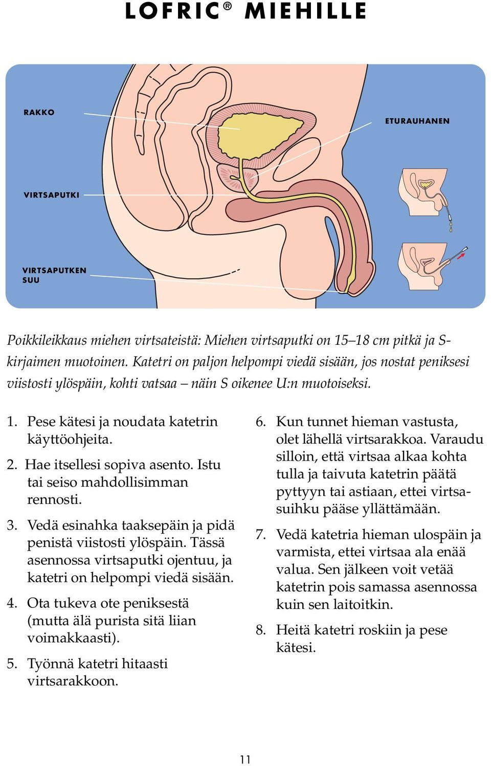 Hae itsellesi sopiva asento. Istu tai seiso mahdollisimman rennosti. 3. Vedä esinahka taaksepäin ja pidä penistä viistosti ylöspäin.