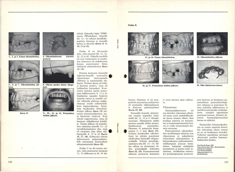 Potilas B on 40-vuotias mies, jolta puuttui dd. 15, 12, 22, 25 ja 46.