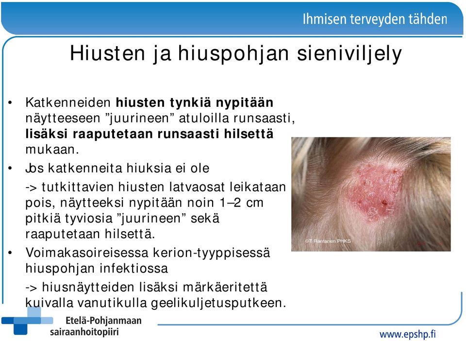 Jos katkenneita hiuksia ei ole -> tutkittavien hiusten latvaosat leikataan pois, näytteeksi nypitään noin 1 2 cm