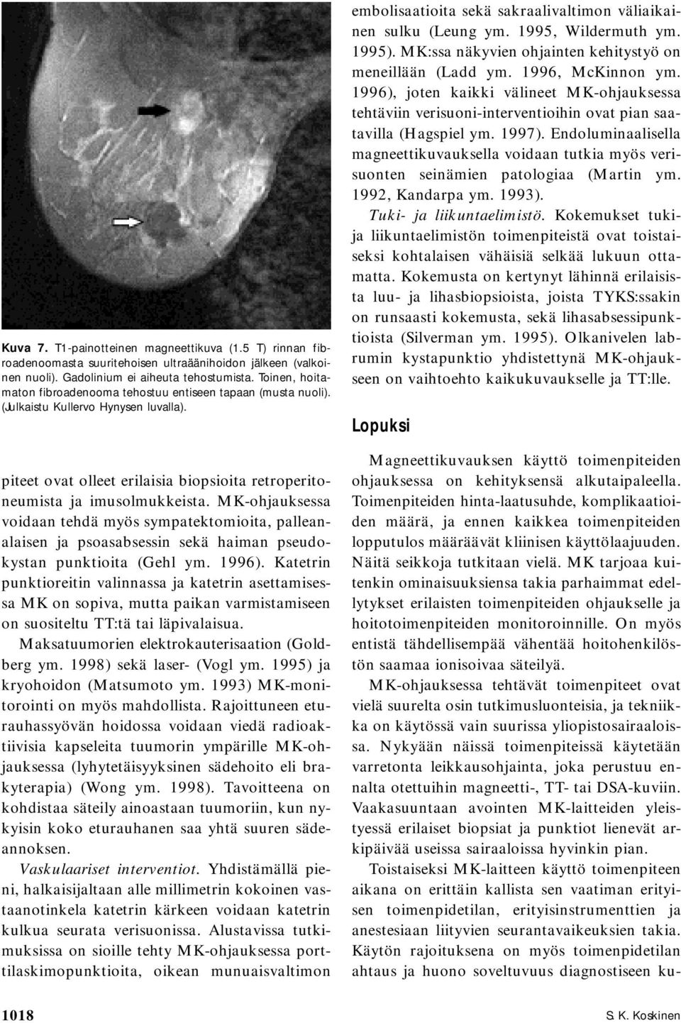 MK-ohjauksessa voidaan tehdä myös sympatektomioita, palleanalaisen ja psoasabsessin sekä haiman pseudokystan punktioita (Gehl ym. 1996).
