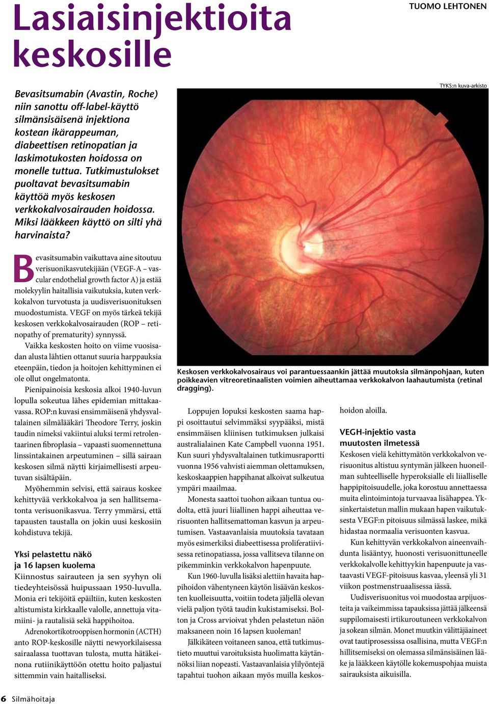 TYKS:n kuva-arkisto Bevasitsumabin vaikuttava aine sitoutuu verisuonikasvutekijään (VEGF-A vascular endothelial growth factor A) ja estää molekyylin haitallisia vaikutuksia, kuten verkkokalvon